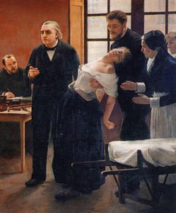 Stupor Hypnosis Catatonic