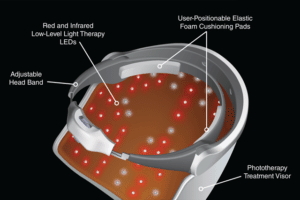 iDerma back inside mask