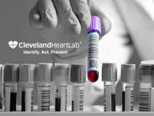 cleveland heart lab